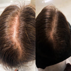 Triple Action Hair Elixir